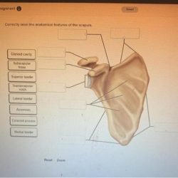 Correctly label the anatomical features of the scapula