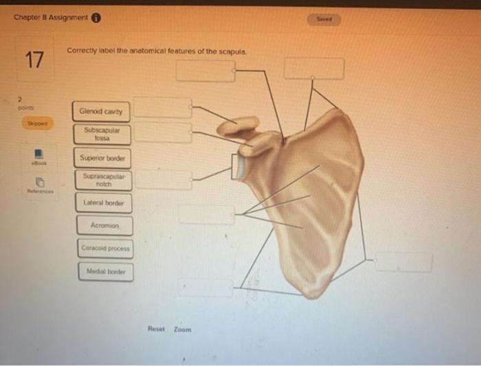 Correctly label the anatomical features of the scapula