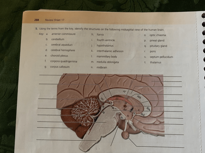 Exercise 14 gross anatomy of the brain and cranial nerves