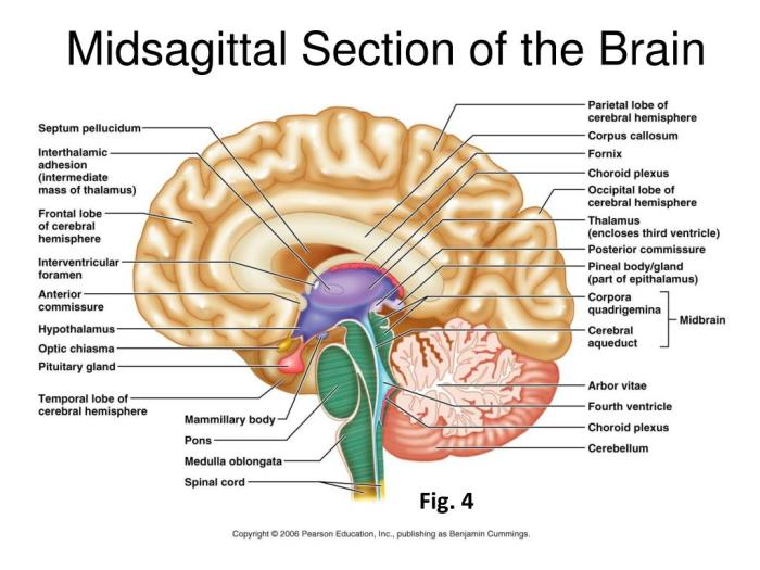 Exercise 14 gross anatomy of the brain and cranial nerves